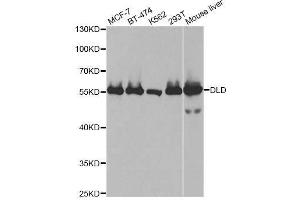 Western blot analysis of extracts of various cell lines, using DLD antibody. (DLD Antikörper  (AA 36-300))