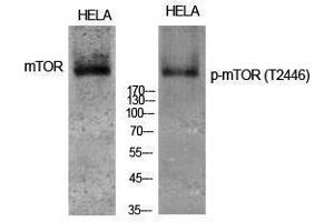 Western Blotting (WB) image for anti-Mechanistic Target of Rapamycin (serine/threonine Kinase) (mTOR) (pThr2446) antibody (ABIN3179552) (MTOR Antikörper  (pThr2446))