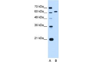 WB Suggested Anti-LMNB2 Antibody Titration:  0. (Lamin B2 Antikörper  (N-Term))