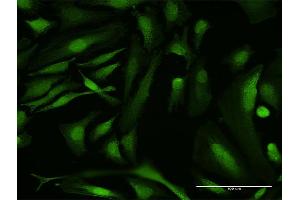 Immunofluorescence of purified MaxPab antibody to RBMY1A1 on HeLa cell. (RBMY1A1 Antikörper  (AA 1-356))