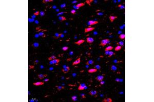 Immunofluorescence of paraffin embedded rat brain using rasgrf1 (ABIN7073422) at dilution of 1:2000 (400x lens)