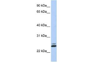 WB Suggested Anti-JAZF1 Antibody Titration:  0. (JAZF1 Antikörper  (N-Term))