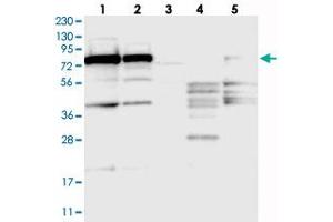 Western blot analysis of Lane 1: RT-4, Lane 2: U-251 MG, Lane 3: Human Plasma, Lane 4: Liver, Lane 5: Tonsil with SRP72 polyclonal antibody  at 1:250-1:500 dilution.