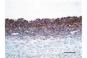Immunohistochemistry (IHC) image for anti-Vascular Endothelial Growth Factor A (VEGFA) (Isoform 164) antibody (ABIN110156)