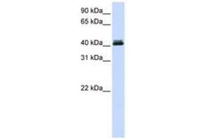 Image no. 1 for anti-Calcium Activated Nucleotidase 1 (CANT1) (AA 324-373) antibody (ABIN6741151) (CANT1 Antikörper  (AA 324-373))