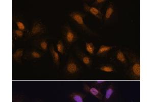 Immunofluorescence (IF) image for anti-RNA Binding Motif Protein 39 (RBM39) antibody (ABIN7258648)