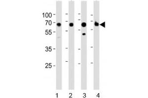 Western blot analysis of lysate from 1) human kidney, 2) mouse kidney, 3) mouse liver and 4) rat kidney tested with ACSM5 antibody at 1:1000.