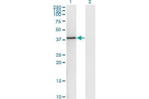 Western Blotting (WB) image for anti-DnaJ (Hsp40) Homolog, Subfamily B, Member 6 (DNAJB6) (AA 72-172) antibody (ABIN523423)