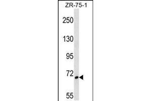 Western blot analysis in ZR-75-1 cell line lysates (35ug/lane). (SH3BP1 Antikörper  (AA 419-446))