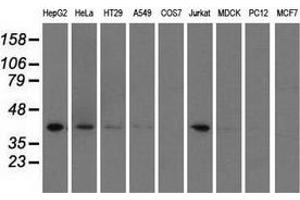Western blot analysis of extracts (35 µg) from 9 different cell lines by using anti-HIBCH monoclonal antibody.