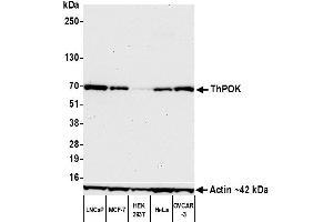 Western Blotting (WB) image for anti-ThPok (AA 250-300) antibody (ABIN7453988)
