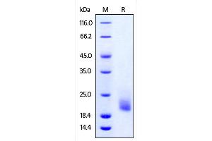 Cynomolgus TIGIT, His Tag on SDS-PAGE under reducing (R) condition. (TIGIT Protein (AA 89-208) (His tag))