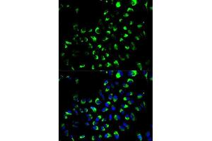 Immunofluorescence analysis of A549 cells using AK4 antibody. (AK4 Antikörper  (AA 1-223))