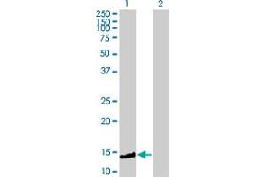 Western Blot analysis of FXC1 expression in transfected 293T cell line by FXC1 MaxPab polyclonal antibody. (TIMM10B Antikörper  (AA 1-103))