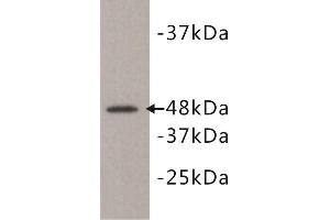 Western Blotting (WB) image for anti-Kinase D-Interacting Substrate, 220kDa (KIDINS220) antibody (ABIN1854930) (KIDINS220 Antikörper)
