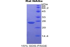 SDS-PAGE analysis of Rat NAGa Protein. (NAGA Protein)