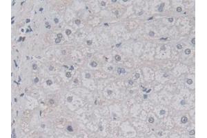 Immunohistochemistry (IHC) image for anti-Lactamase, beta (LACTB) (AA 313-547) antibody (ABIN7436687)