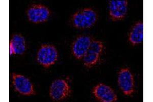 Immunofluorescence staining of HeLa cells using STIM1 monoclonal antibody, clone CDN3H4 . (STIM1 Antikörper  (C-Term))