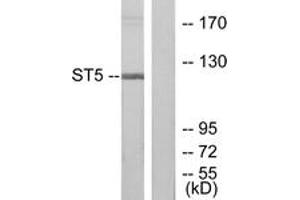 Western Blotting (WB) image for anti-Suppression of Tumorigenicity 5 (ST5) (AA 411-460) antibody (ABIN2889536) (ST5 Antikörper  (AA 411-460))