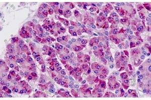 Human Pancreas: Formalin-Fixed, Paraffin-Embedded (FFPE) (PAK6 Antikörper  (AA 268-297))