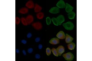 ABIN6265661 and ABIN6276530 staining Hela cells(30 min of UV treatment) by IF/ICC. (Cardiac Troponin T2 Antikörper  (C-Term))