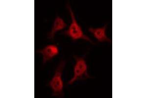 Immunofluorescence (fixed cells) (IF/ICC) image for anti-BCL6 Co-Repressor (BCOR) (Internal Region) antibody (ABIN6257962)