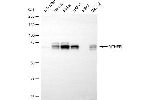 anti-Methylenetetrahydrofolate Reductase (NAD(P)H) (MTHFR) antibody