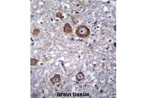 Immunohistochemistry (IHC) image for anti-APG8b antibody (ABIN2996776) (APG8b Antikörper)