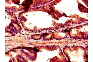 Immunohistochemistry of paraffin-embedded human prostate tissue using ABIN7161004 at dilution of 1:100 (NOX1 Antikörper  (AA 418-564))