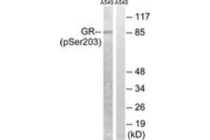 Western blot analysis of extracts from A549 cells treated with dexamethason 10nM 1h, using GR (Phospho-Ser203) Antibody. (GR (AA 171-220), (pSer203) Antikörper)