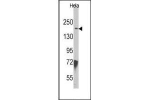 Image no. 1 for anti-Lysine (K)-Specific Demethylase 6B (Kdm6b) (N-Term) antibody (ABIN356549) (Kdm6b Antikörper  (N-Term))