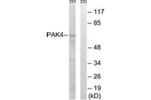 Western blot analysis of extracts from K562 cells, treated with PMA 125ng/ml 30', using PAK4/5/6 (Ab-474) Antibody. (PAK4 Antikörper  (AA 441-490))