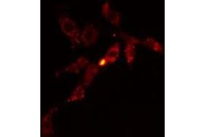 ABIN6278574 staining HeLa cells by IF/ICC. (GIT1 Antikörper  (Internal Region))