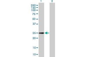 Western Blot analysis of NXNL1 expression in transfected 293T cell line by NXNL1 MaxPab polyclonal antibody. (NXNL1 Antikörper  (AA 1-212))