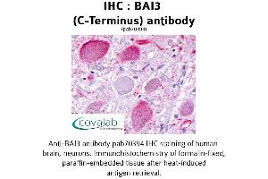 Image no. 1 for anti-Brain-Specific Angiogenesis Inhibitor 3 (BAI3) (C-Term) antibody (ABIN1732208)