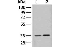 Western blot analysis of Mouse brain tissue and Rat brain tissue lysates using SLC25A27 Polyclonal Antibody at dilution of 1:350 (SLC25A27 Antikörper)