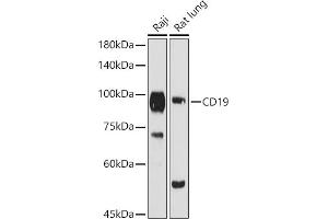 Western blot analysis of extracts of various cell lines, using CD19 antibody (ABIN3023663, ABIN3023664, ABIN3023665 and ABIN6219683) at 1:1000 dilution. (CD19 Antikörper  (AA 351-556))