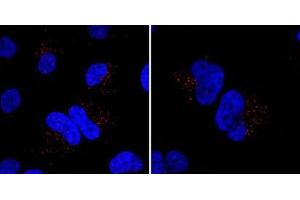 Immunofluorescent staining of Hela cells incubated with MIB Antibody (N-term) (Cat  (ABIN388956 and ABIN2839208)) at a dilution of 1:20. (MIB1 Antikörper  (N-Term))