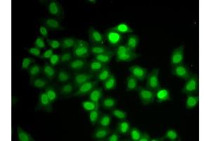 Immunofluorescence analysis of U2OS cells using MAD1L1 antibody. (MAD1L1 Antikörper)