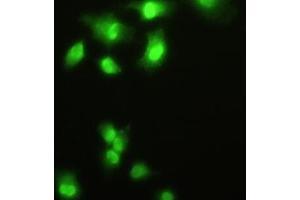 Detection of HDGF in A549 cells using Polyclonal Antibody to Hepatoma Derived Growth Factor (HDGF) (HDGF Antikörper  (AA 10-240))