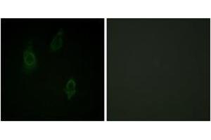Immunofluorescence analysis of HepG2 cells, using PKC-pan (Phospho-Thr497) Antibody.