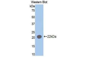 Western Blotting (WB) image for anti-Aminoacyl tRNA Synthetase Complex-Interacting Multifunctional Protein 1 (AIMP1) (AA 148-312) antibody (ABIN1171689) (AIMP1 Antikörper  (AA 148-312))