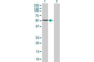 Lane 1: TRIM62 transfected lysate ( 52. (TRIM62 293T Cell Transient Overexpression Lysate(Denatured))