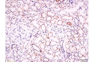 Paraformaldehyde-fixed, paraffin embedded human kidney tissue, Antigen retrieval by boiling in sodium citrate buffer(pH6) for 15min, Block endogenous peroxidase by 3% hydrogen peroxide for 30 minutes, Blocking buffer (normal goat serum) at 37°C for 20min, Antibody incubation with Rabbit Anti-EphB2 R Polyclonal Antibody, Unconjugated  at 1:200 overnight at 4°C, followed by a conjugated secondary and DAB staining (EphB2 R (AA 101-200) Antikörper)