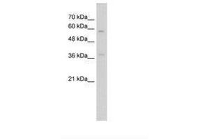 Image no. 1 for anti-Integrin, beta-Like 1 (With EGF-Like Repeat Domains) (ITGBL1) (AA 151-200) antibody (ABIN203424) (ITGBL1 Antikörper  (AA 151-200))