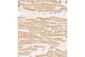 Immunohistochemical analysis of paraffin-embedded human heart tissue using (ABIN6244160 and ABIN6578849) performed on the Leica® BOND RXm. (MYL2 Antikörper  (AA 42-75))