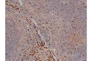 Immunohistochemistry (IHC) image for anti-LIM Domain Kinase 1 (LIMK1) (pThr508) antibody (ABIN6255701)