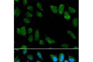 Immunofluorescence analysis of MCF-7 cells using IL1RN Polyclonal Antibody (IL1RN Antikörper)