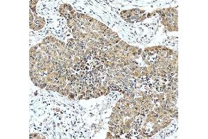 anti-4-Hydroxyphenylpyruvate Dioxygenase (HPD) (AA 12-357) antibody