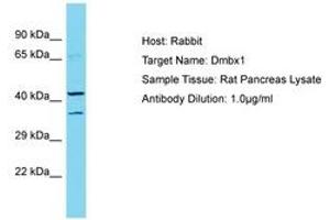 Image no. 1 for anti-Diencephalon/mesencephalon Homeobox 1 (DMBX1) (AA 191-240) antibody (ABIN6750283) (DMBX1 Antikörper  (AA 191-240))